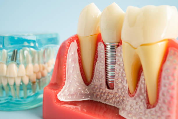 Our Range of Dental Services in Harmony Grove, CA